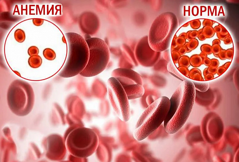 Диагностика анемий Диагностика анемий